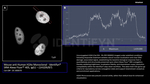 H2Ax Antibody in Immunocytochemistry (ICC/IF)