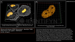 ATRIP Antibody in Immunocytochemistry (ICC/IF)