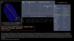 ATRIP Antibody in Immunocytochemistry (ICC/IF)