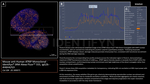 ATRIP Antibody in Immunocytochemistry (ICC/IF)
