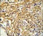DC13 Antibody in Immunohistochemistry (IHC)