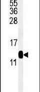 DC13 Antibody in Western Blot (WB)