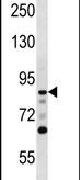 DCLK1 Antibody in Western Blot (WB)