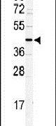 DSCC1 Antibody in Western Blot (WB)