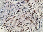 DCK Antibody in Immunohistochemistry (Paraffin) (IHC (P))