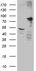 DCLK1 Antibody in Western Blot (WB)