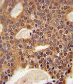 DCLRE1B Antibody in Immunohistochemistry (IHC)
