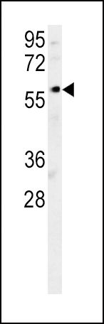 DCLRE1B Antibody in Western Blot (WB)