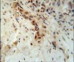 Artemis Antibody in Immunohistochemistry (IHC)