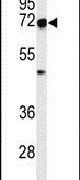 Artemis Antibody in Western Blot (WB)