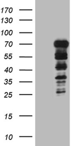 DCP1B Antibody in Western Blot (WB)
