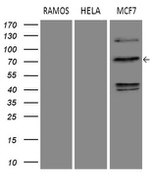 DCP1B Antibody in Western Blot (WB)