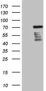 DCP1B Antibody in Western Blot (WB)