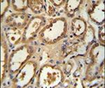 DCP2 Antibody in Immunohistochemistry (IHC)