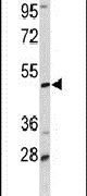 DCP2 Antibody in Western Blot (WB)