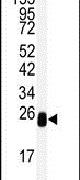 DCXR Antibody in Western Blot (WB)
