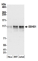 DDHD1 Polyclonal Antibody