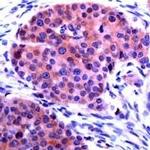 CHOP Antibody in Immunohistochemistry (IHC)