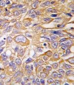 DDIT4 Antibody in Immunohistochemistry (IHC)