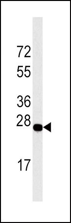 DDIT4 Antibody in Western Blot (WB)