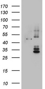 DDOST Antibody in Western Blot (WB)