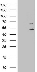 DDOST Antibody in Western Blot (WB)
