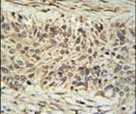 DDX23 Antibody in Immunohistochemistry (IHC)