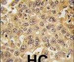 DDX3 Antibody in Immunohistochemistry (IHC)