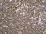 DDX39B Antibody in Immunohistochemistry (Paraffin) (IHC (P))