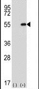 DDX39 Antibody in Western Blot (WB)