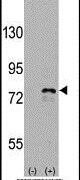DDX3 Antibody in Western Blot (WB)