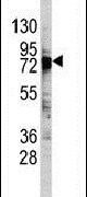 DDX3 Antibody in Western Blot (WB)