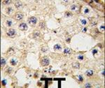 DDX4 Antibody in Immunohistochemistry (IHC)