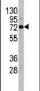 DDX4 Antibody in Western Blot (WB)