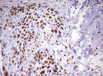 DDX56 Antibody in Immunohistochemistry (Paraffin) (IHC (P))