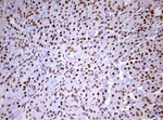 DDX56 Antibody in Immunohistochemistry (Paraffin) (IHC (P))
