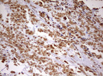 DDX56 Antibody in Immunohistochemistry (Paraffin) (IHC (P))
