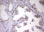 DDX56 Antibody in Immunohistochemistry (Paraffin) (IHC (P))