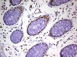 DDX56 Antibody in Immunohistochemistry (Paraffin) (IHC (P))