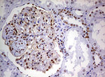 DDX56 Antibody in Immunohistochemistry (Paraffin) (IHC (P))