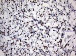 DDX56 Antibody in Immunohistochemistry (Paraffin) (IHC (P))