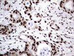 DDX56 Antibody in Immunohistochemistry (Paraffin) (IHC (P))