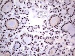 DDX56 Antibody in Immunohistochemistry (Paraffin) (IHC (P))