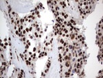 DDX56 Antibody in Immunohistochemistry (Paraffin) (IHC (P))