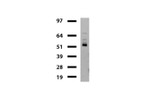 DDX56 Antibody in Western Blot (WB)
