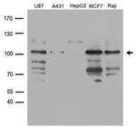 DDX58 Antibody in Western Blot (WB)