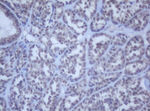 DDX59 Antibody in Immunohistochemistry (Paraffin) (IHC (P))