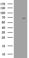 DDX59 Antibody in Western Blot (WB)