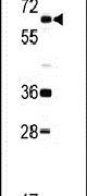 DDX5 Antibody in Western Blot (WB)