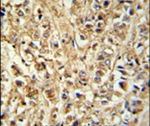 DDX6 Antibody in Immunohistochemistry (IHC)